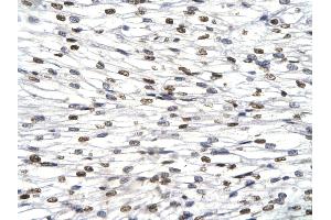 Rabbit Anti-HES1 Antibody       Paraffin Embedded Tissue:  Human cardiac cell   Cellular Data:  Epithelial cells of renal tubule  Antibody Concentration:   4.