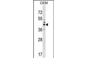 Western blot analysis in CEM cell line lysates (35ug/lane). (CEACAM6 anticorps  (AA 188-214))