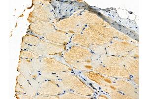Phospho-SPHK2 (Ser387) Antibody at 1/100 staining Rat skin tissue by IHC-P. (SPHK2 anticorps  (pSer387))