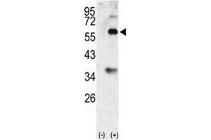 Western blot analysis of BMP3 antibody and 293 cell lysate (2 ug/lane) either nontransfected (Lane 1) or transiently transfected with the BMP3 gene (2). (BMP3 anticorps  (AA 8-36))
