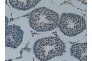 anti-Vascular Cell Adhesion Molecule 1 (VCAM1) (AA 369-658) antibody