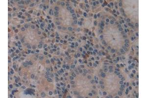 IHC-P analysis of Human Stomach Tissue, with DAB staining. (VPREB1 anticorps  (AA 33-135))