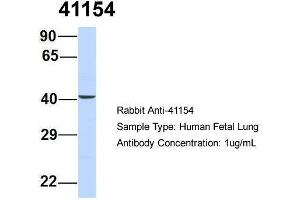 Host: Rabbit  Target Name: 41154  Sample Tissue: Human Fetal Lung  Antibody Dilution: 1. (Septin 2 anticorps  (N-Term))