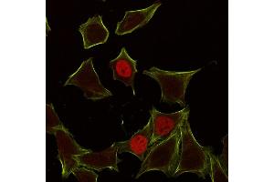 Immunofluorescence Analysis of HeLa cells labeling p21 with p21 Mouse Monoclonal Antibody (CIP1/823) followed by Goat anti-Mouse IgG-CF555 (Red).