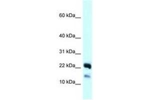 Image no. 1 for anti-NADH Dehydrogenase (Ubiquinone) 1 beta Subcomplex, 10, 22kDa (NDUFB10) (C-Term) antibody (ABIN6747916) (NDUFB10 anticorps  (C-Term))