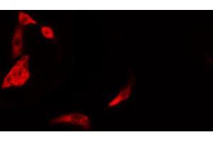 ABIN6274387 staining Hela cells by IF/ICC.