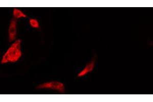 ABIN6274387 staining Hela cells by IF/ICC. (DAK anticorps  (Internal Region))
