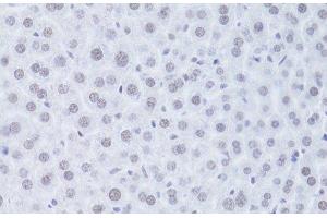 Immunohistochemistry of paraffin-embedded Mouse liver using CDKN1A Polyclonal Antibody at dilution of 1:100 (40x lens). (p21 anticorps)