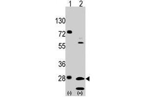 Western blot analysis of GRB2 (arrow) using rabbit GRB2 polyclonal antibody . (GRB2 anticorps  (Tyr209))