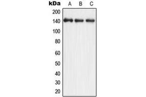 Western blot analysis of eNOS expression in A549 (A), HuvEc (B), rat brain (C) whole cell lysates. (ENOS anticorps  (Center))