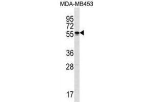 Western Blotting (WB) image for anti-Spermatogenesis and Oogenesis Specific Basic Helix-Loop-Helix 2 (SOHLH2) antibody (ABIN3000290) (SOHLH2 anticorps)