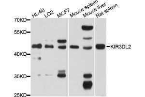 Western blot analysis of extracts of various cell lines, using KIR3DL2 antibody (ABIN6003815) at 1/1000 dilution. (KIR3DL2 anticorps)