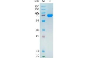 Human NRG1 Protein, hFc Tag on SDS-PAGE under reducing condition. (Neuregulin 1 Protein (NRG1) (Fc Tag))