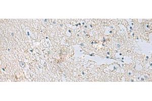 Immunohistochemistry of paraffin-embedded Human brain tissue using RDH5 Polyclonal Antibody at dilution of 1:50(x200) (RDH5 anticorps)