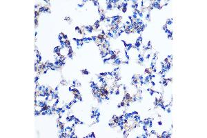 Immunohistochemistry of paraffin-embedded Rat lung using PKM2 Rabbit pAb (ABIN6128296, ABIN6145714, ABIN6145715 and ABIN6218076) at dilution of 1:100 (40x lens). (PKM anticorps  (AA 11-221))
