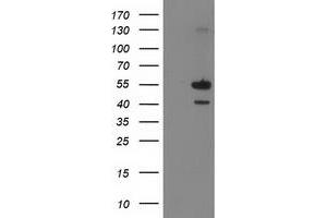 Image no. 1 for anti-Phosphatidylinositol-5-Phosphate 4-Kinase, Type II, alpha (PIP4K2A) antibody (ABIN1500226) (PIP4K2A anticorps)