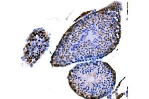 IHC analysis of DMC1 using anti-DMC1 antibody (ABIN7601468). (DMC1 anticorps  (AA 36-283))
