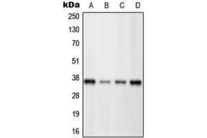 Western blot analysis of BRN3C expression in HeLa (A), Jurkat (B), Raw264.