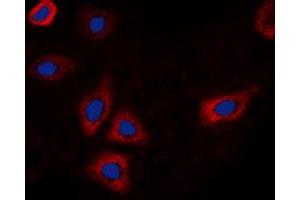 Immunofluorescent analysis of EGFR (pT693) staining in HEK293T cells. (EGFR anticorps  (pSer693))