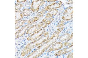 Immunohistochemistry of paraffin-embedded mouse kidney using TIRAP Rabbit mAb (ABIN7270842) at dilution of 1:100 (40x lens).