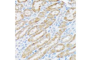 Immunohistochemistry of paraffin-embedded mouse kidney using TIRAP Rabbit mAb (ABIN7270842) at dilution of 1:100 (40x lens). (TIRAP anticorps)