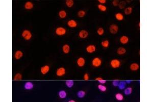 Immunofluorescence analysis of HeLa cells using MonoMethyl-NONO-R357/R365 Polyclonal Antibody at dilution of 1:100 (40x lens). (NONO anticorps  (meArg357, meArg365))