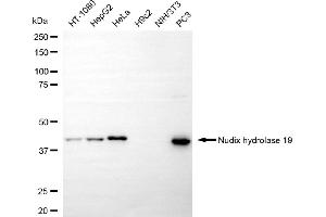Western blotting analysis using nudix hydrolase 19 antibody (ABIN7799682). (Recombinant Nucleoside Diphosphate-Linked Moiety X Motif 19 (NUDT19) anticorps)