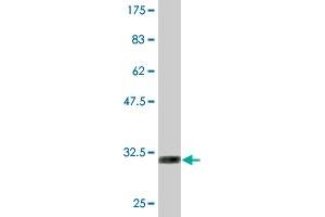 Western Blot detection against Immunogen (30.