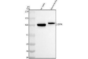 Western blot analysis of ESPN using anti-ESPN antibody (ABIN7600060).