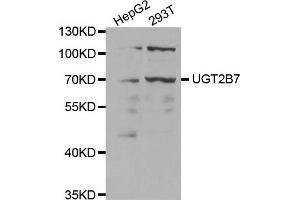 Western Blotting (WB) image for anti-UDP Glucuronosyltransferase 2 Family, Polypeptide B7 (UGT2B7) antibody (ABIN1875408) (UGT2B7 anticorps)