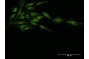 Immunofluorescence of purified MaxPab antibody to ZFP36 on HeLa cell.