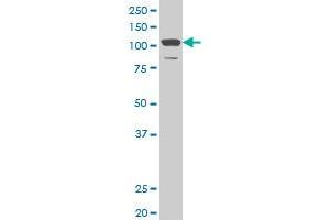 DAAM1 monoclonal antibody (M03), clone 4H3.