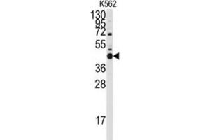 Western Blotting (WB) image for anti-BCL2-Like 14 (Apoptosis Facilitator) (BCL2L14) (BH3 Domain) antibody (ABIN2997105)