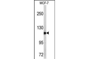 Western blot analysis of PSA antibody in MCF-7 cell line lysates (35ug/lane) (Prostate Specific Antigen anticorps  (C-Term))