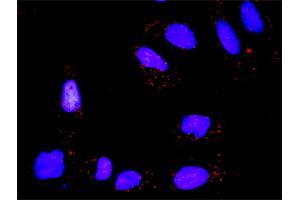 Proximity Ligation Analysis of protein-protein interactions between TP53 and CSNK2A1.