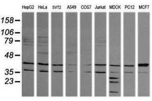 Image no. 4 for anti-Mitogen-Activated Protein Kinase 9 (MAPK9) antibody (ABIN1498927)