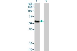Western Blot analysis of AGER expression in transfected 293T cell line by AGER monoclonal antibody (M02C), clone 1C1. (RAGE anticorps  (AA 23-404))