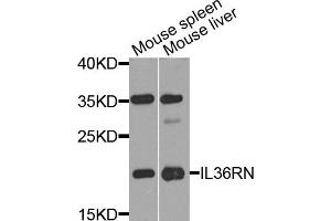Western blot analysis of extract of mouse spleen and mouse liver cells, using IL36RN antibody.