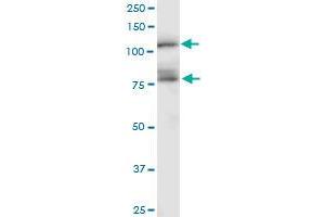 CDH11 monoclonal antibody (M04), clone 1A5.