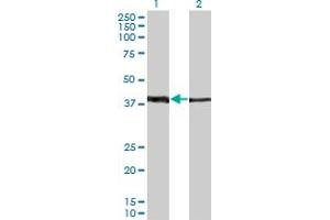 Western Blot analysis of ZNF187 expression in transfected 293T cell line by ZNF187 monoclonal antibody (M01A), clone 1D9. (ZNF187 anticorps  (AA 1-325))