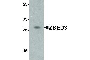 Western Blot of ZBED3 Antibody - Western Blot of ZBED3 antibody. (ZBED3 anticorps  (C-Term))