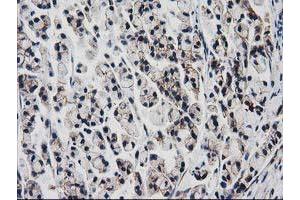 Immunohistochemistry (IHC) image for anti-Vascular Cell Adhesion Molecule 1 (VCAM1) antibody (ABIN1497155)
