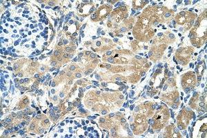 Image no. 1 for anti-Transmembrane 9 Superfamily Member 1 (TM9SF1) (AA 201-250) antibody (ABIN205056)