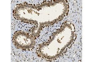 IHC analysis of FOXP1 using anti-FOXP1 antibody (ABIN7602780). (FOXP1 anticorps  (C-Term))