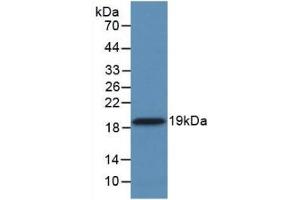 Detection of Recombinant CYPA, Human using Monoclonal Antibody to Cyclophilin A (CYPA)
