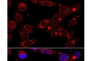 Immunofluorescence analysis of HeLa cells using GM130 Polyclonal Antibody at dilution of 1:400 (60x lens).