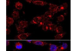 Immunofluorescence analysis of HeLa cells using GM130 Polyclonal Antibody at dilution of 1:400 (60x lens). (Golgin A2 (GOLGA2) anticorps)