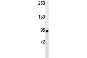 Western blot analysis of ABCF1 antibody and NCI-H460 lysate.