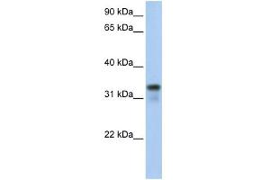 WB Suggested Anti-GLYATL2 Antibody Titration:  0. (GLYATL2 anticorps  (Middle Region))