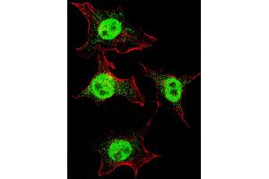 Fluorescent confocal image of HeLa cells stained with ITGA6 (isoform 2 ) antibody. (ITGA6 anticorps  (Isoform 2))